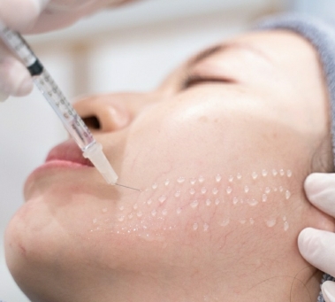 Tiêm Meso Đồng Xoài – Làm Đẹp Chuẩn Y Khoa, Da Căng Mướt Không Cần Nghỉ Dưỡng