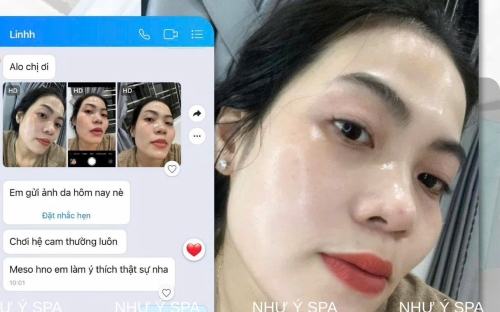 MESO TRẮNG DA, CĂNG BÓNG ĐỒNG XOÀI 